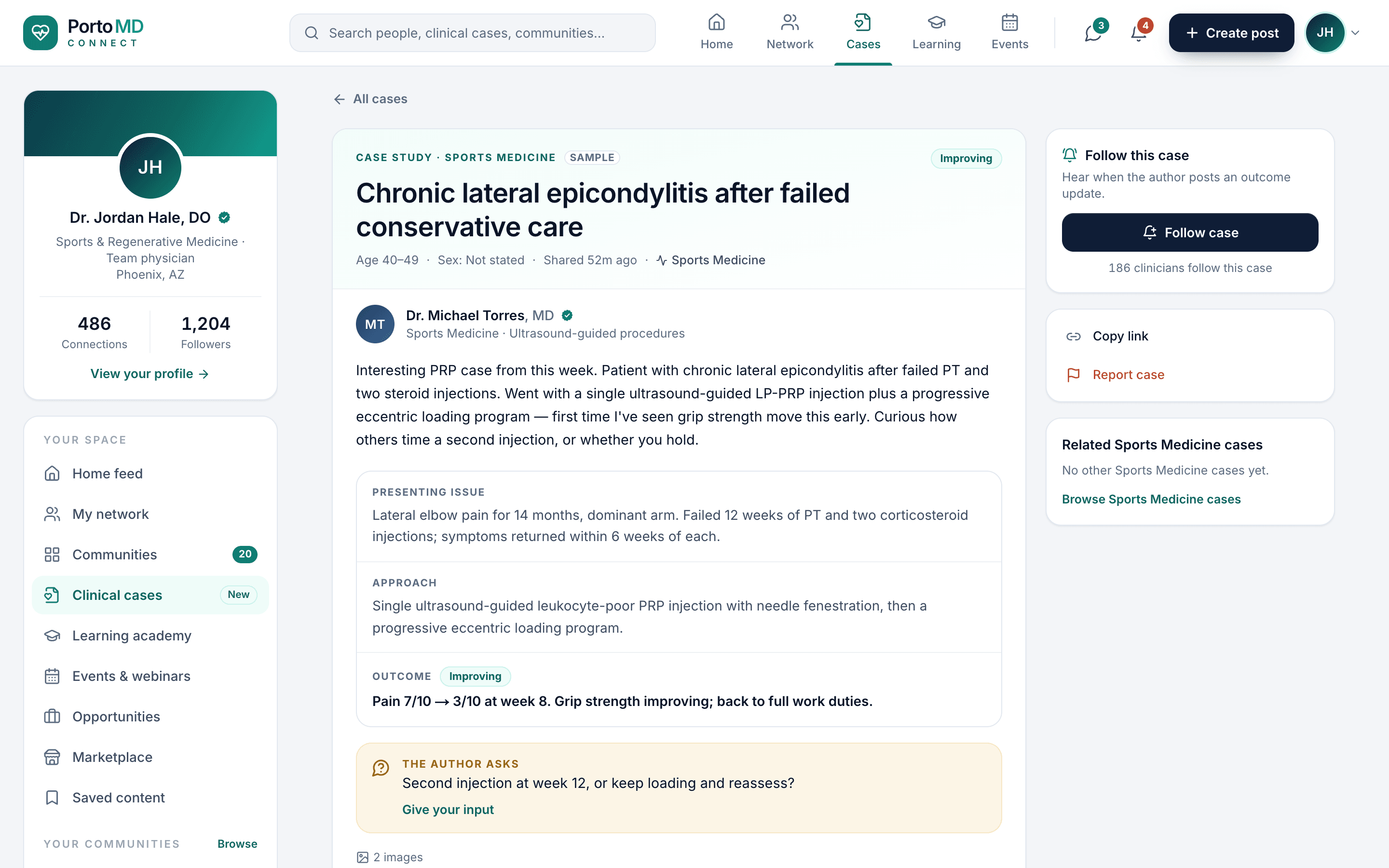 A de-identified case study on Porto Connect laid out as presenting issue, approach and outcome, with a Follow case button and the author's question for peers.